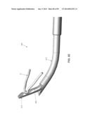 METHOD AND APPARATUS FOR PASSING SUTURE THROUGH TISSUE diagram and image