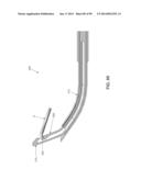 METHOD AND APPARATUS FOR PASSING SUTURE THROUGH TISSUE diagram and image