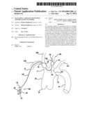 Occluding Catheter and Method for Prevention of Stroke diagram and image