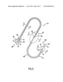 Occluding Catheter and Method for Prevention of Stroke diagram and image