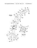 Occluding Catheter and Method for Prevention of Stroke diagram and image