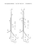 DETACHABLE METAL BALLOON DELIVERY DEVICE AND METHOD diagram and image