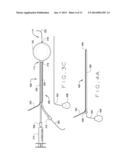 DETACHABLE METAL BALLOON DELIVERY DEVICE AND METHOD diagram and image