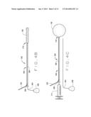 DETACHABLE METAL BALLOON DELIVERY DEVICE AND METHOD diagram and image