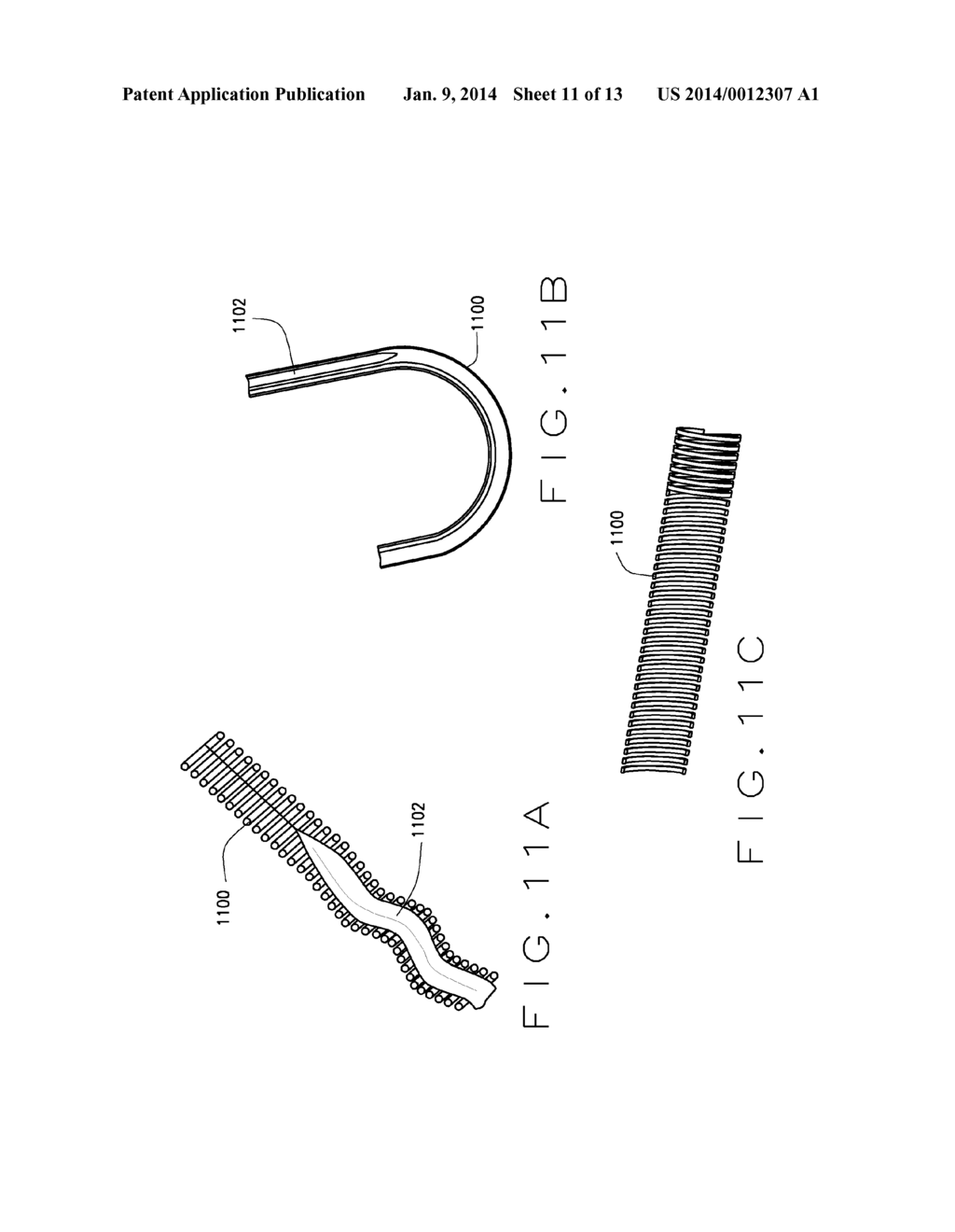 DETACHABLE METAL BALLOON DELIVERY DEVICE AND METHOD - diagram, schematic, and image 12