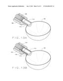 DETACHABLE METAL BALLOON DELIVERY DEVICE AND METHOD diagram and image