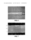 DEVICE AND METHOD FOR MANAGEMENT OF ANEURISM, PERFORATION AND OTHER     VASCULAR ABNORMALITIES diagram and image