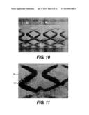 DEVICE AND METHOD FOR MANAGEMENT OF ANEURISM, PERFORATION AND OTHER     VASCULAR ABNORMALITIES diagram and image