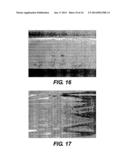 DEVICE AND METHOD FOR MANAGEMENT OF ANEURISM, PERFORATION AND OTHER     VASCULAR ABNORMALITIES diagram and image