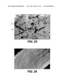 DEVICE AND METHOD FOR MANAGEMENT OF ANEURISM, PERFORATION AND OTHER     VASCULAR ABNORMALITIES diagram and image