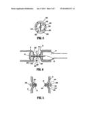 ANNULAR SUPPORT STRUCTURES diagram and image