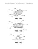 DEVICES AND METHOD FOR TREATMENT OF SPONDYLOTIC DISEASE diagram and image