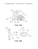 DEVICES AND METHOD FOR TREATMENT OF SPONDYLOTIC DISEASE diagram and image