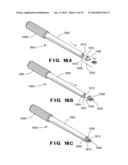 DEVICES AND METHOD FOR TREATMENT OF SPONDYLOTIC DISEASE diagram and image