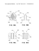 DEVICES AND METHOD FOR TREATMENT OF SPONDYLOTIC DISEASE diagram and image