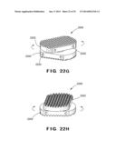 DEVICES AND METHOD FOR TREATMENT OF SPONDYLOTIC DISEASE diagram and image