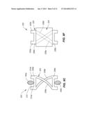 SYSTEMS AND METHODS FOR STABILIZING A FUNCTIONAL SPINAL UNIT diagram and image