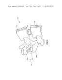 SYSTEMS AND METHODS FOR STABILIZING A FUNCTIONAL SPINAL UNIT diagram and image