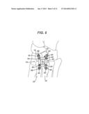 MIDFOOT BONE PLATE SYSTEM diagram and image