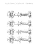 SCREW IMPLANT AND SYSTEM AND METHOD FOR LOCKING A SCREW IN AN IMPLANT     PLATE diagram and image