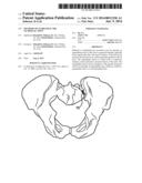 Methods of Stabilizing the Sacroiliac Joint diagram and image