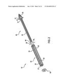 Methods of Stabilizing the Sacroiliac Joint diagram and image