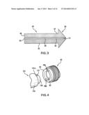 Methods of Stabilizing the Sacroiliac Joint diagram and image