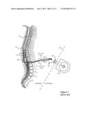 External Charger for a Medical Implantable Device Using Field Inducing     Coils to Improve Coupling diagram and image