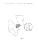 BALLOON SIZING DEVICE AND METHOD OF POSITIONING A PROSTHETIC HEART VALVE diagram and image