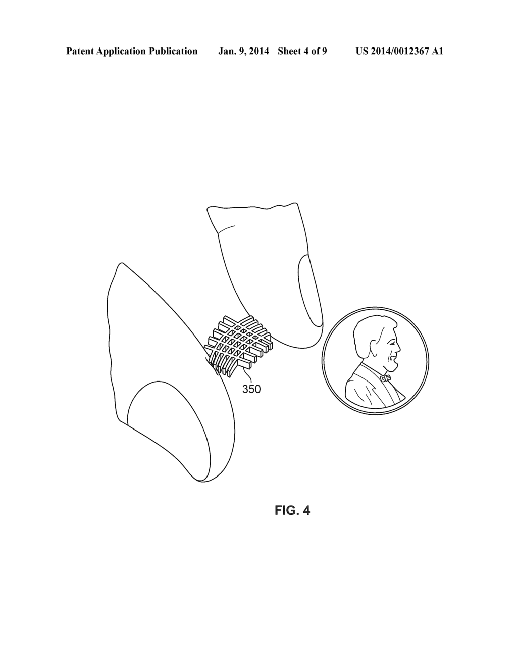 BALLOON SIZING DEVICE AND METHOD OF POSITIONING A PROSTHETIC HEART VALVE - diagram, schematic, and image 05