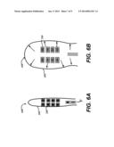 BALLOON SIZING DEVICE AND METHOD OF POSITIONING A PROSTHETIC HEART VALVE diagram and image