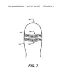 BALLOON SIZING DEVICE AND METHOD OF POSITIONING A PROSTHETIC HEART VALVE diagram and image