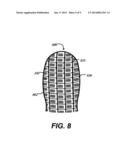 BALLOON SIZING DEVICE AND METHOD OF POSITIONING A PROSTHETIC HEART VALVE diagram and image