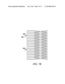 DEVICES AND METHODS FOR RETRIEVABLE INTRA-ATRIAL IMPLANTS diagram and image