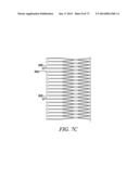 DEVICES AND METHODS FOR RETRIEVABLE INTRA-ATRIAL IMPLANTS diagram and image