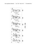 DEVICES AND METHODS FOR RETRIEVABLE INTRA-ATRIAL IMPLANTS diagram and image