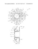 DEVICES AND METHODS FOR RETRIEVABLE INTRA-ATRIAL IMPLANTS diagram and image