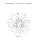 DEVICES AND METHODS FOR RETRIEVABLE INTRA-ATRIAL IMPLANTS diagram and image