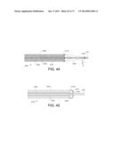 DEVICES AND METHODS FOR RETRIEVABLE INTRA-ATRIAL IMPLANTS diagram and image