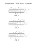 DEVICES AND METHODS FOR RETRIEVABLE INTRA-ATRIAL IMPLANTS diagram and image