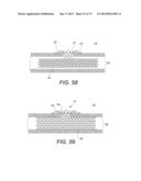 DEVICES AND METHODS FOR RETRIEVABLE INTRA-ATRIAL IMPLANTS diagram and image