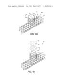 DEVICES AND METHODS FOR RETRIEVABLE INTRA-ATRIAL IMPLANTS diagram and image