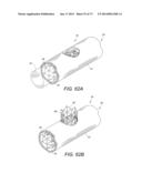 DEVICES AND METHODS FOR RETRIEVABLE INTRA-ATRIAL IMPLANTS diagram and image