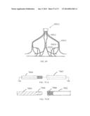 DEVICES AND METHODS FOR RETRIEVABLE INTRA-ATRIAL IMPLANTS diagram and image