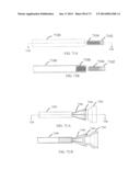 DEVICES AND METHODS FOR RETRIEVABLE INTRA-ATRIAL IMPLANTS diagram and image