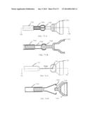 DEVICES AND METHODS FOR RETRIEVABLE INTRA-ATRIAL IMPLANTS diagram and image