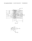 DEVICES AND METHODS FOR RETRIEVABLE INTRA-ATRIAL IMPLANTS diagram and image