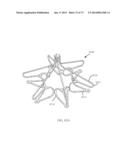 DEVICES AND METHODS FOR RETRIEVABLE INTRA-ATRIAL IMPLANTS diagram and image