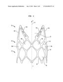 STENT AND IMPLANTABLE VALVE INCORPORATING SAME diagram and image