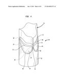 STENT AND IMPLANTABLE VALVE INCORPORATING SAME diagram and image